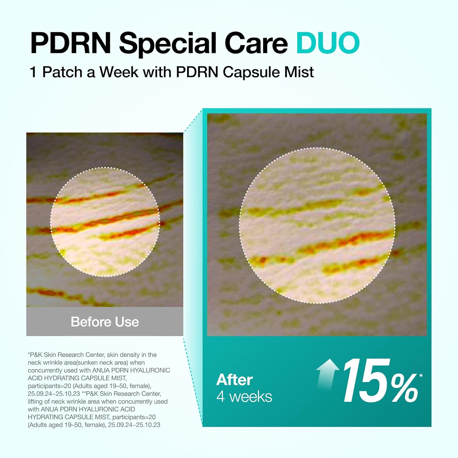 PDRN Collagen Melting Patch For Neck 1 Box (4 Patches)
