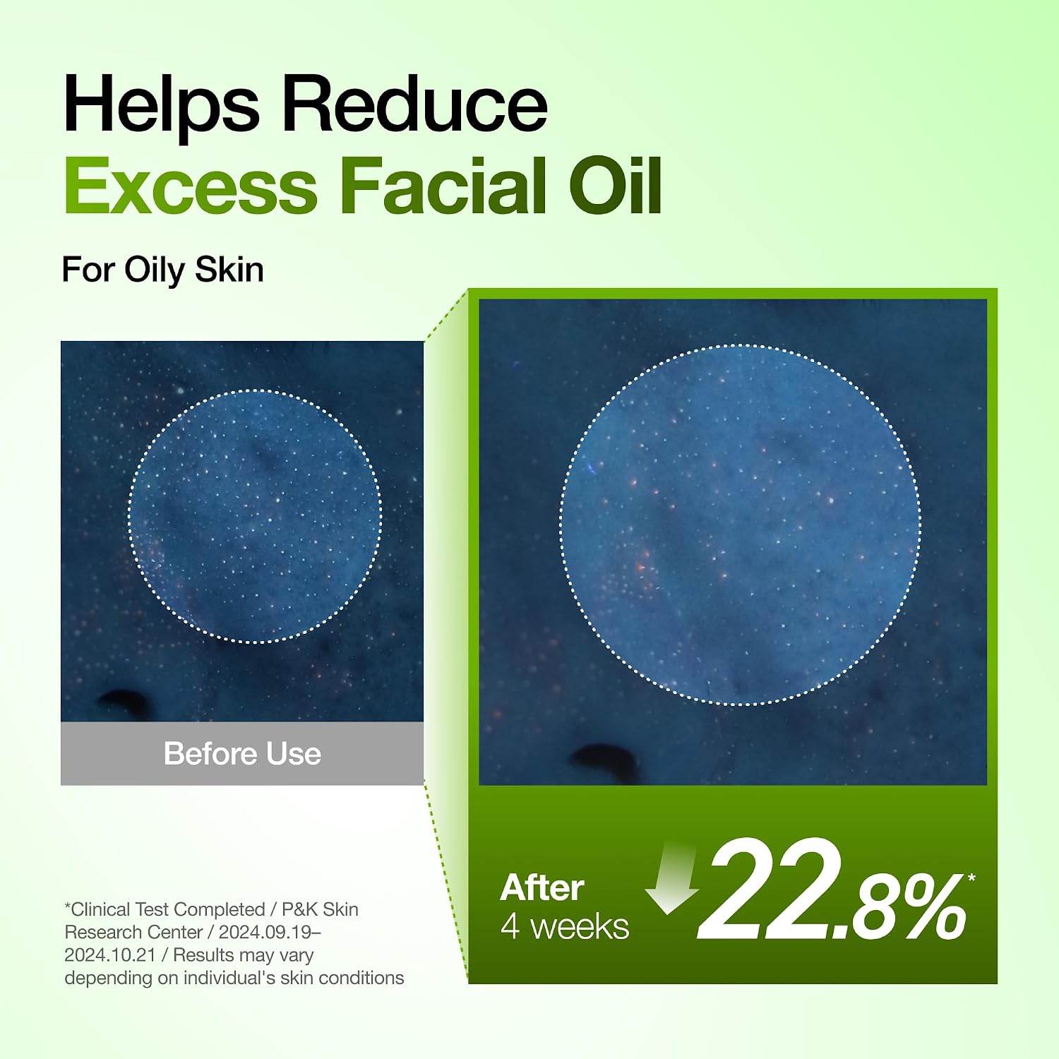 Anua Azelaic Acid 10 Hyaluron Redness Soothing Serum