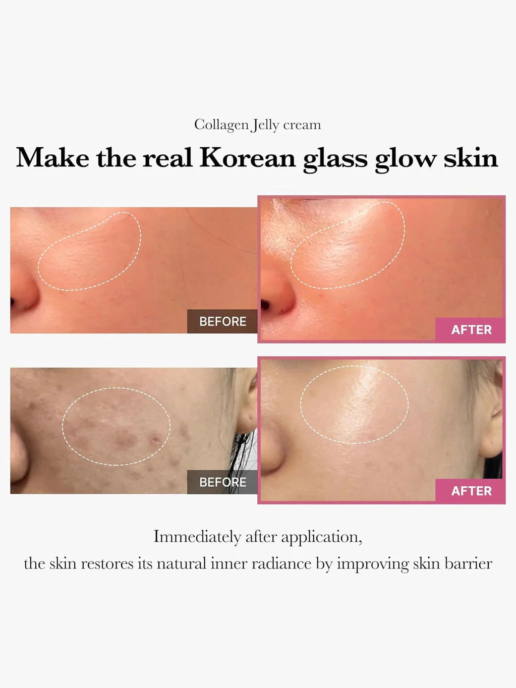 Collagen Jelly Cream