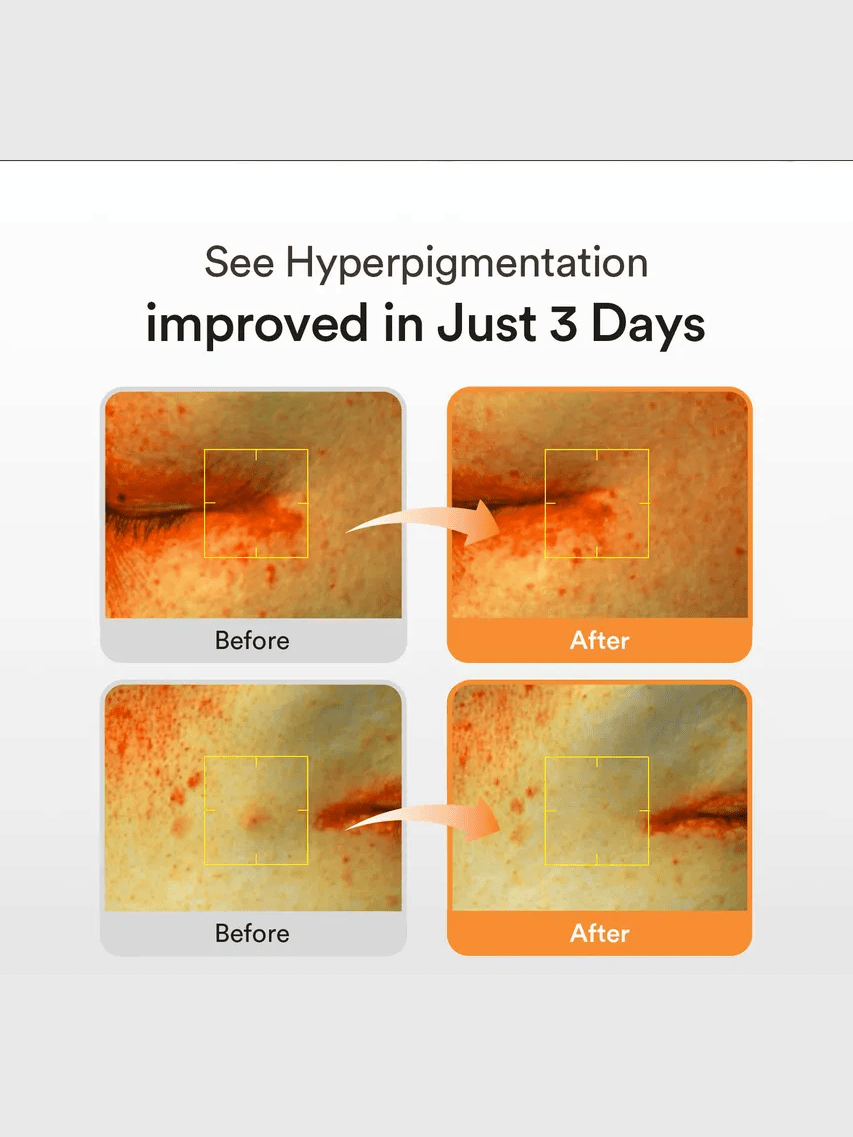 Glutathiosome Dark Spot Serum Vita Drop