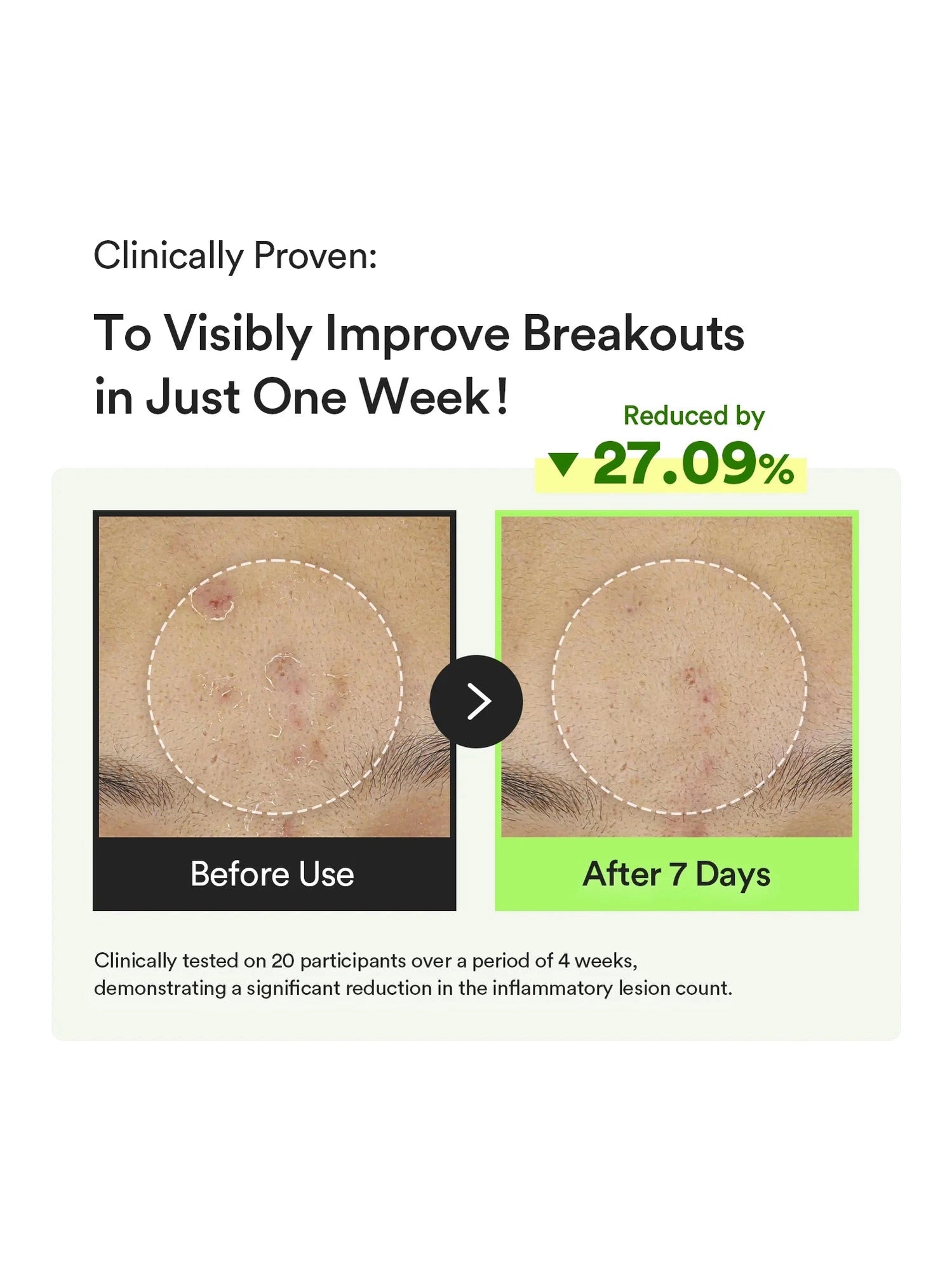 Heartleaf TECA Capsule Serum Calming Drop