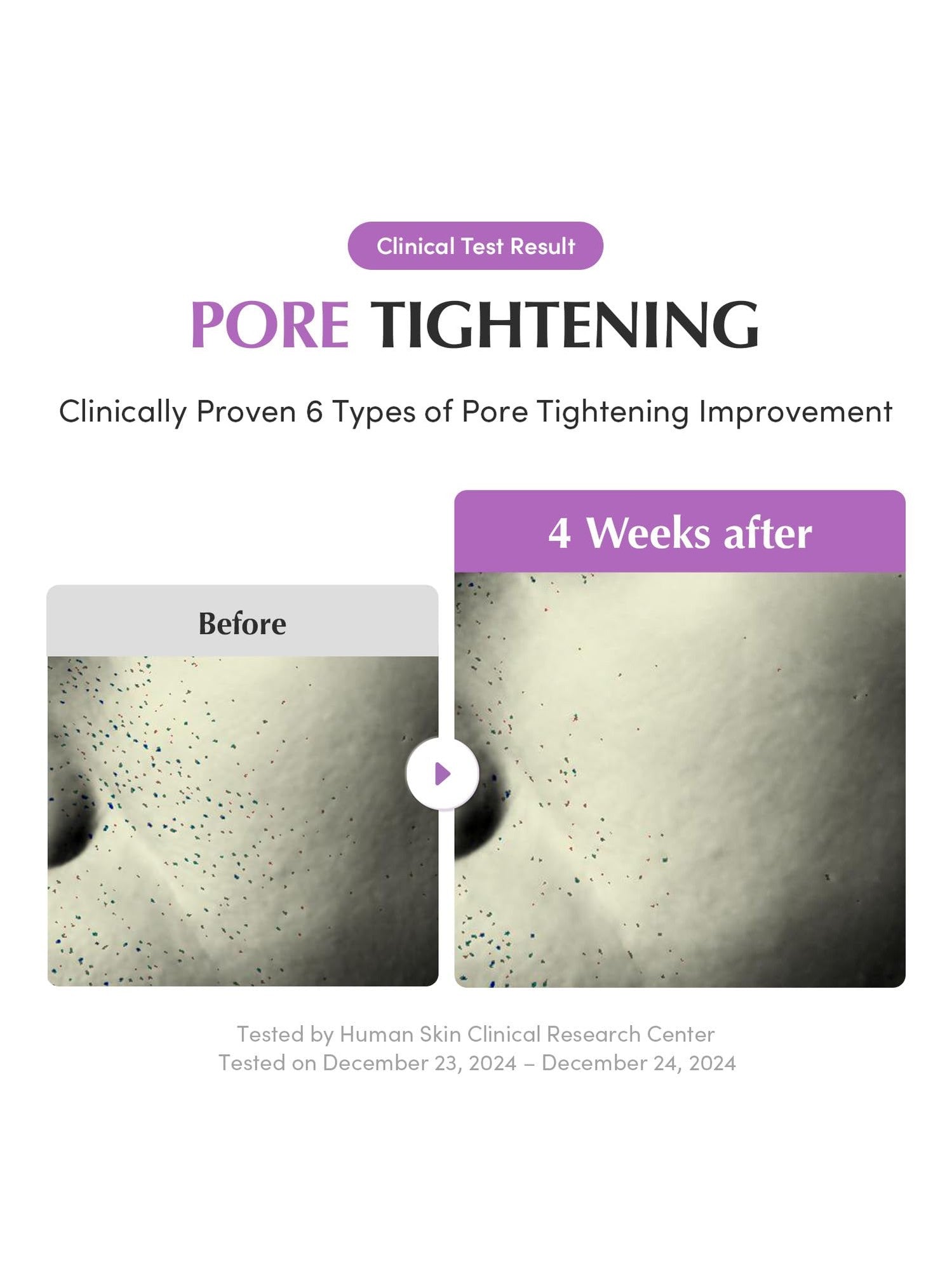 Purple PDRN Pore Minimizing Serum