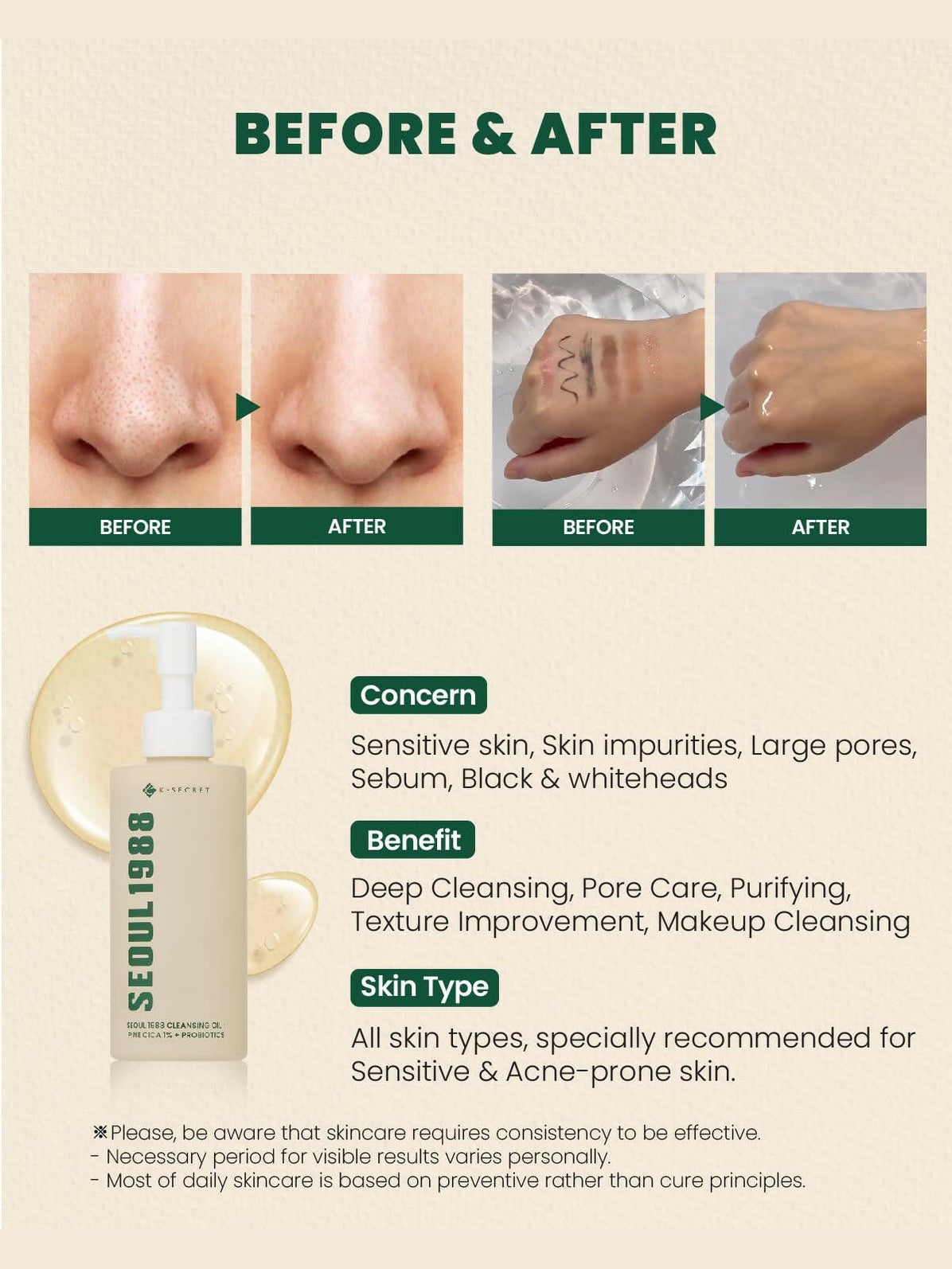 SEOUL 1988 Cleansing Oil : Pine Cica 1% + Probiotics