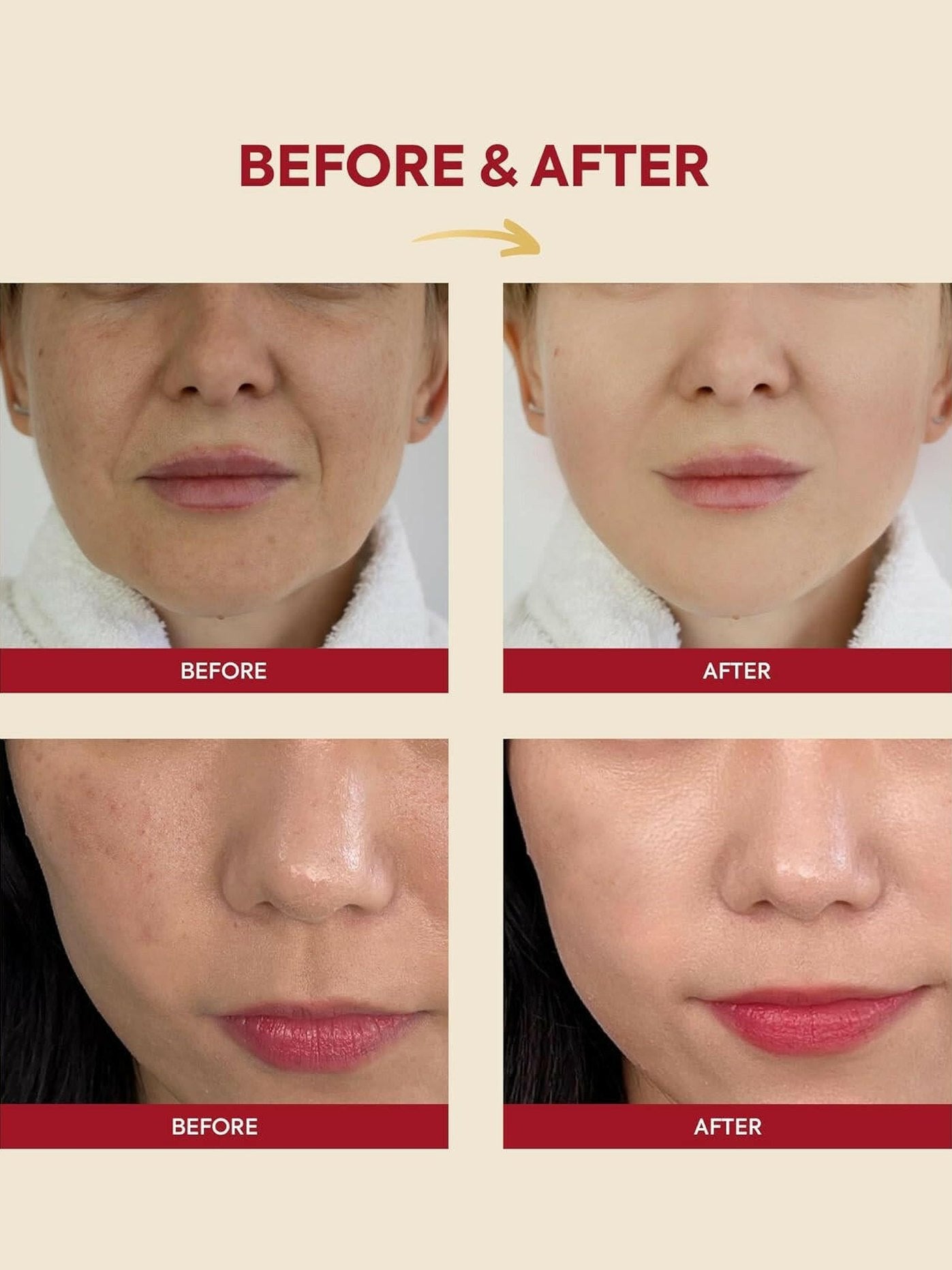 SEOUL 1988 Essence : Snail Mucin 97% + Rice