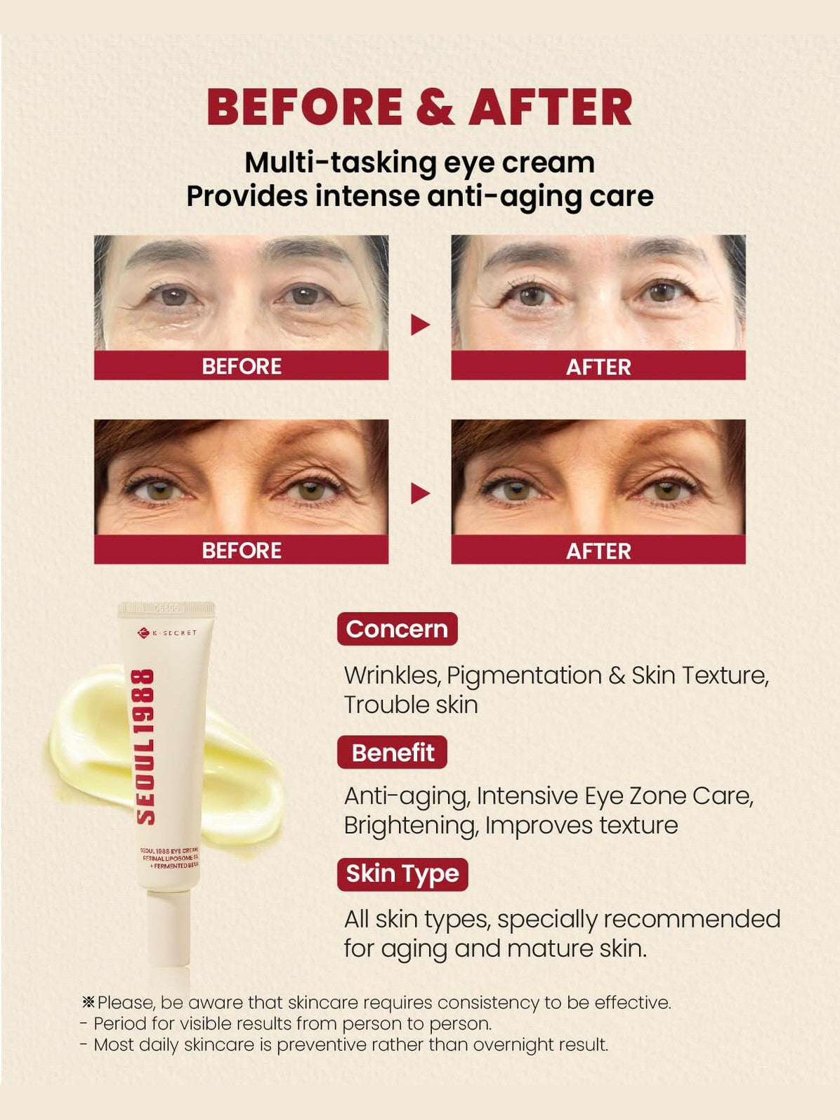 SEOUL 1988 Eye Cream : Retinal Liposome 4% + Fermented Bean