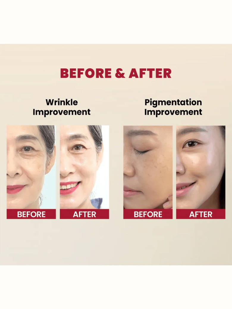 SEOUL 1988 Serum : Retinal Liposome 2% + Black Ginseng