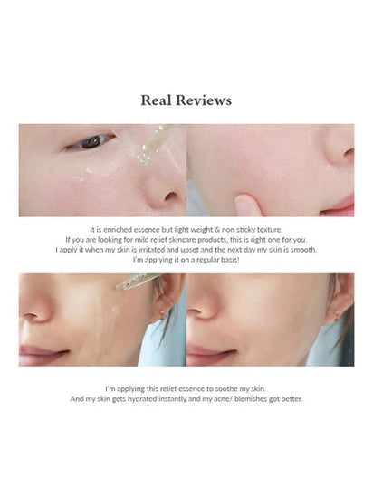 Skin Relief Essence