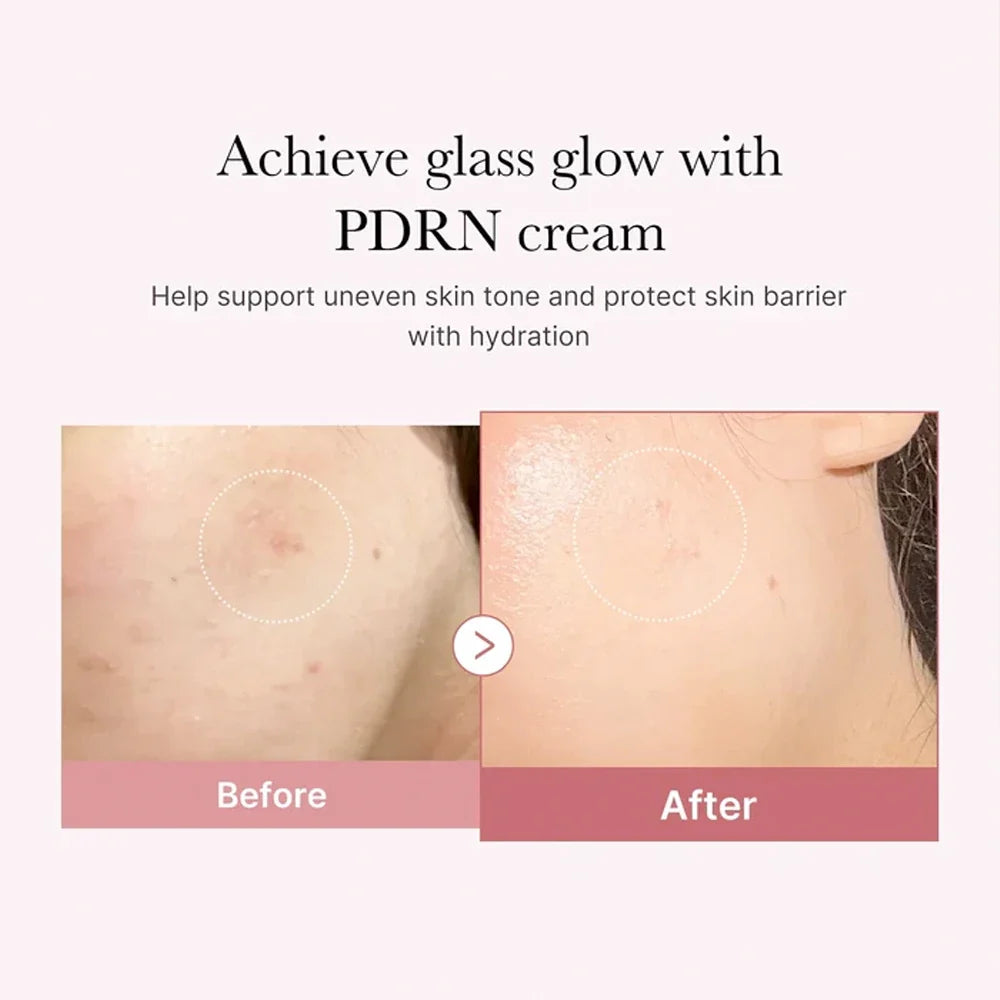 Medicube PDRN Pink Hyaluronic Moisturizing Cream 50ml — Korean salmon DNA PDRN ceramide hyaluronic acid barrier moisturiser Australia